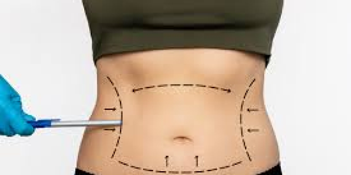 Best Tummy Tuck Surgeon in Dubai: What Patients Should Look For