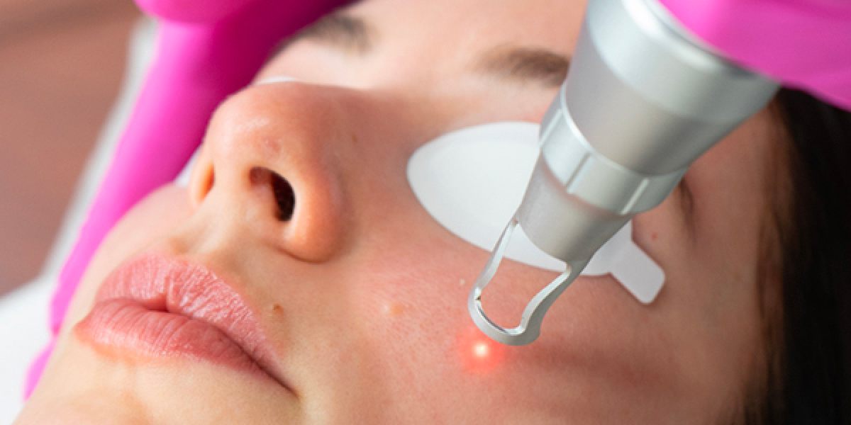 Face Laser Treatment Cost: Laser Technology Matters
