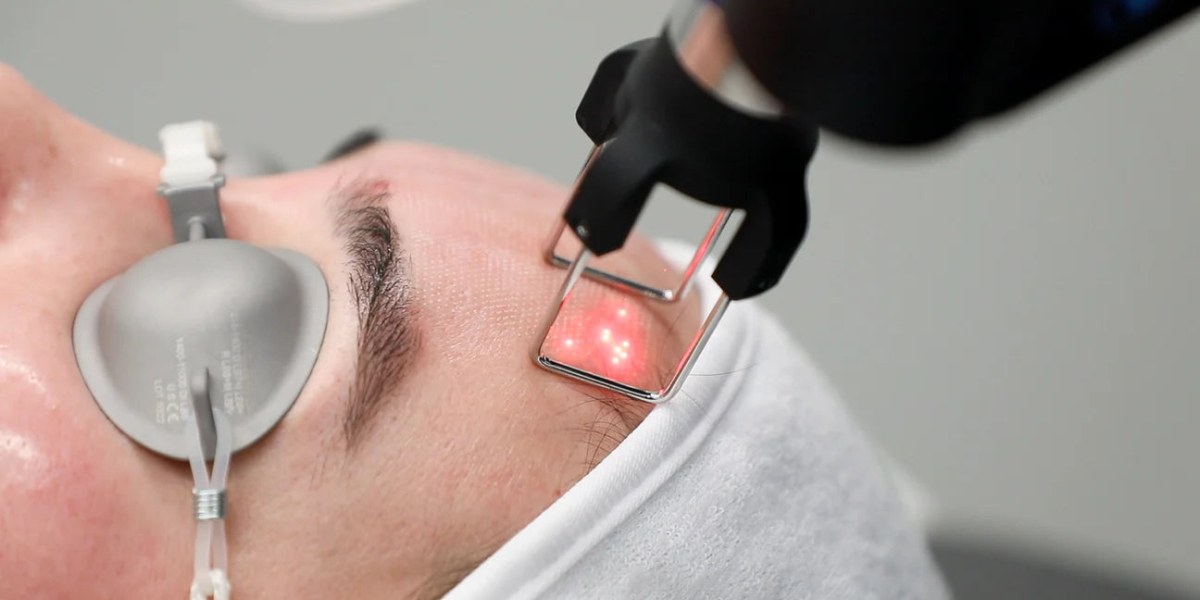 How Many Sessions Are Needed for Picosure Laser Treatment?