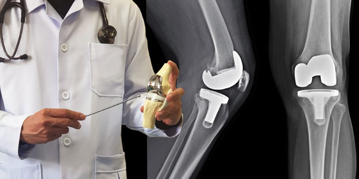 Personalized Orthopaedic Treatment by a Leading Joint Replacement Surgeon in Delhi