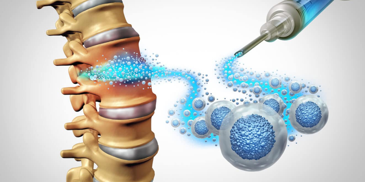 Stem Cell Therapy Innovations in Orthopedics