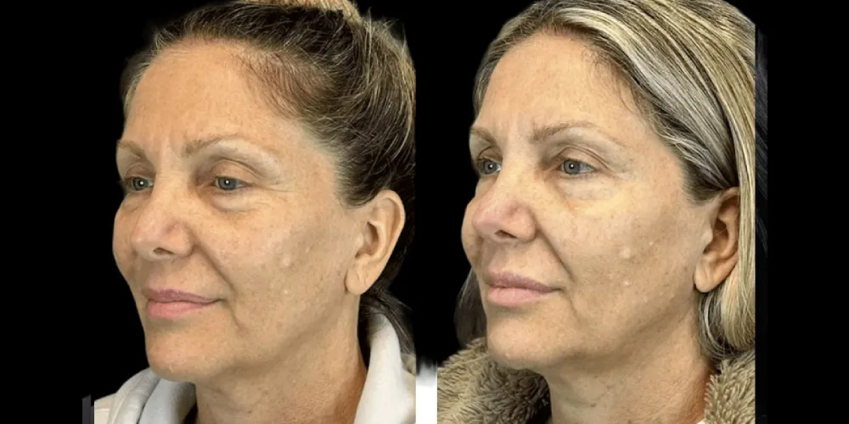 The Role of Expert Doctors at the Best Aesthetic Clinic in Dubai