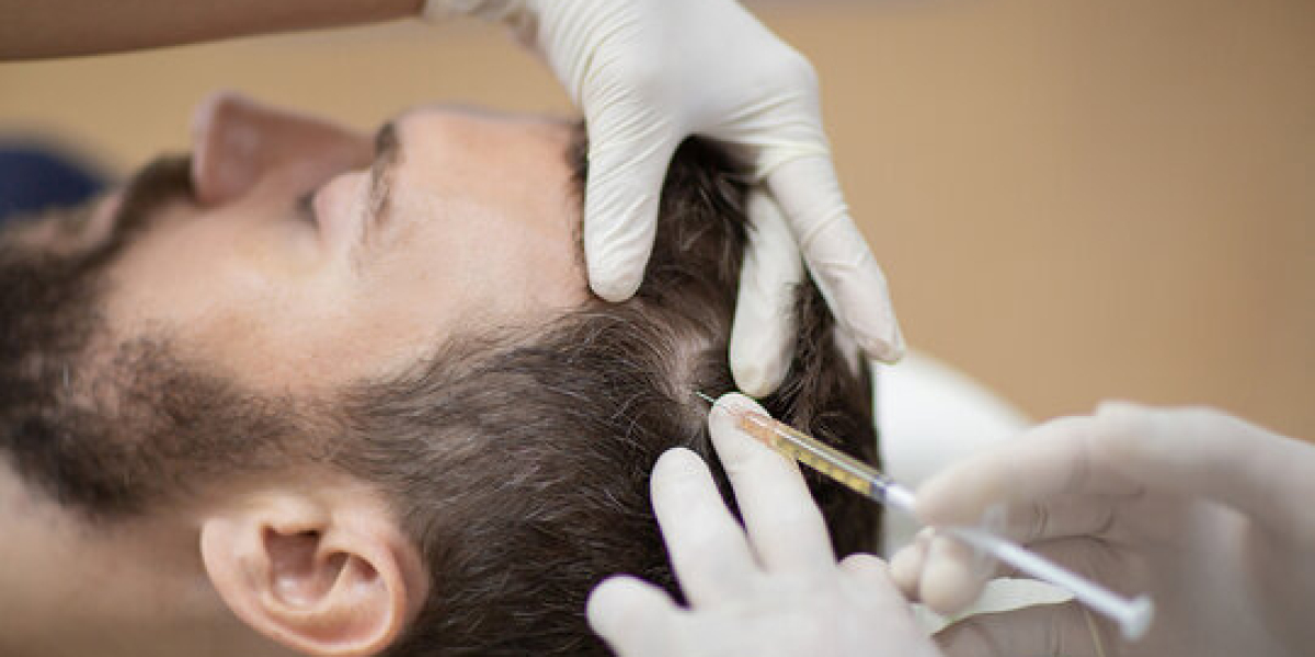 Reveal Healthier Roots With Advanced PRP Hair Treatment Cost Tips