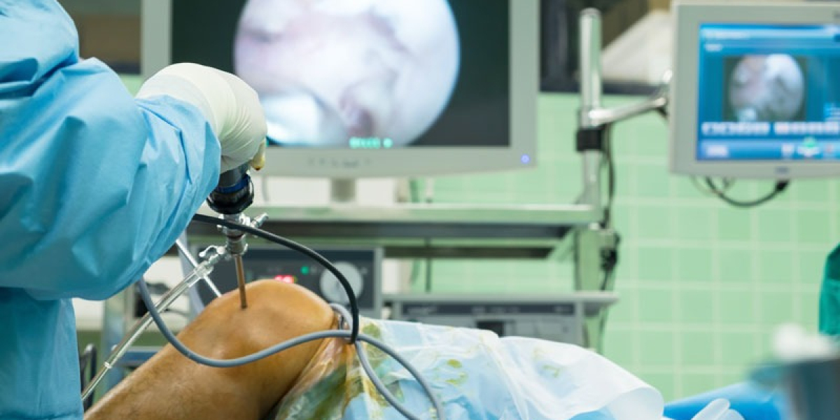 Arthroscopy Surgery Delhi: Minimally Invasive Care for Joint Problems
