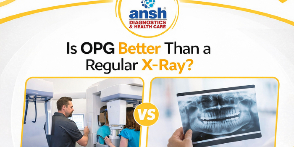 Is OPG Better Than a Regular X-Ray?