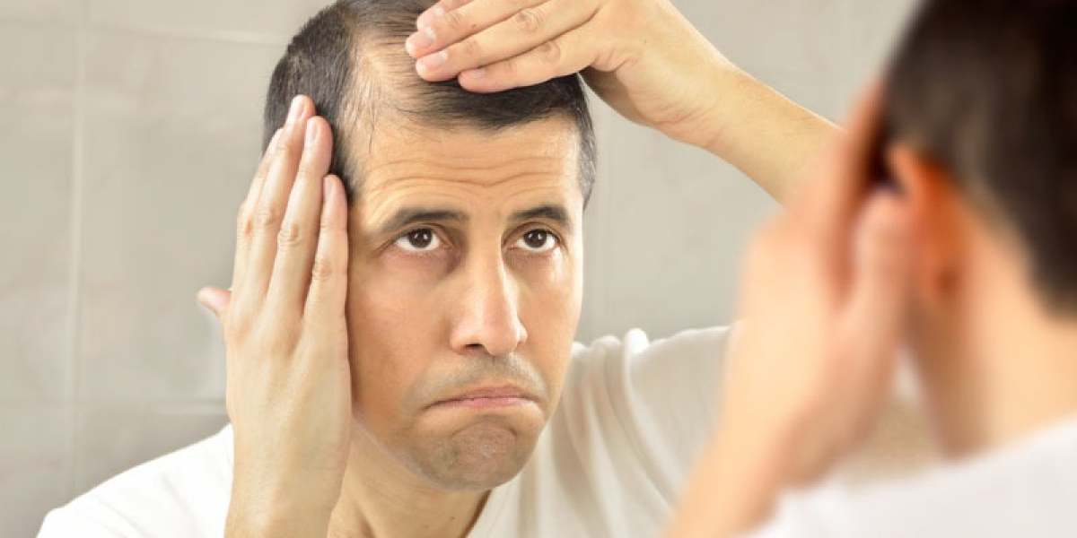 Early Hair Loss Treatment Delhi of Male Pattern Baldness for Better Results