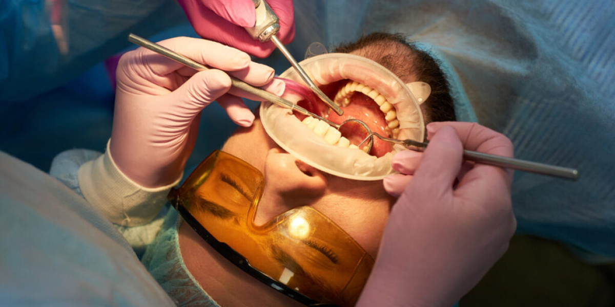 Tooth Removal for Tooth Abscess: Treatment Overview