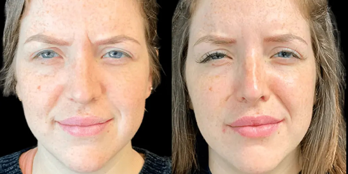 Best Plastic Surgeons in Dubai: Botox Trends and Innovations
