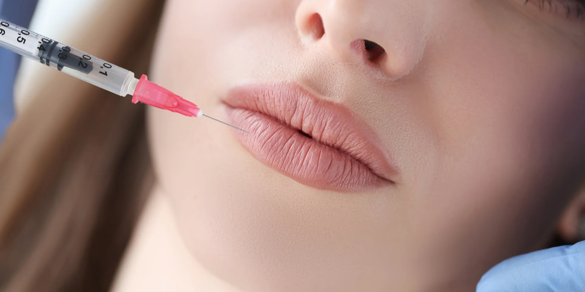 Lip Fillers Injections for Teenagers: What Parents Should Know