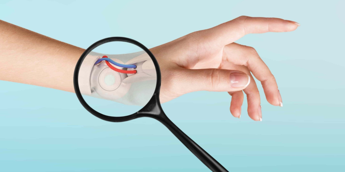 Advanced Total Wrist Replacement Surgery in Delhi: Procedure & Recovery