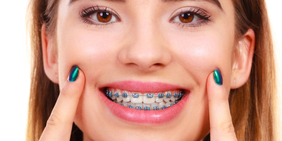 Invisalign Braces Treatment Cost: Tips for Finding Affordable Clinics